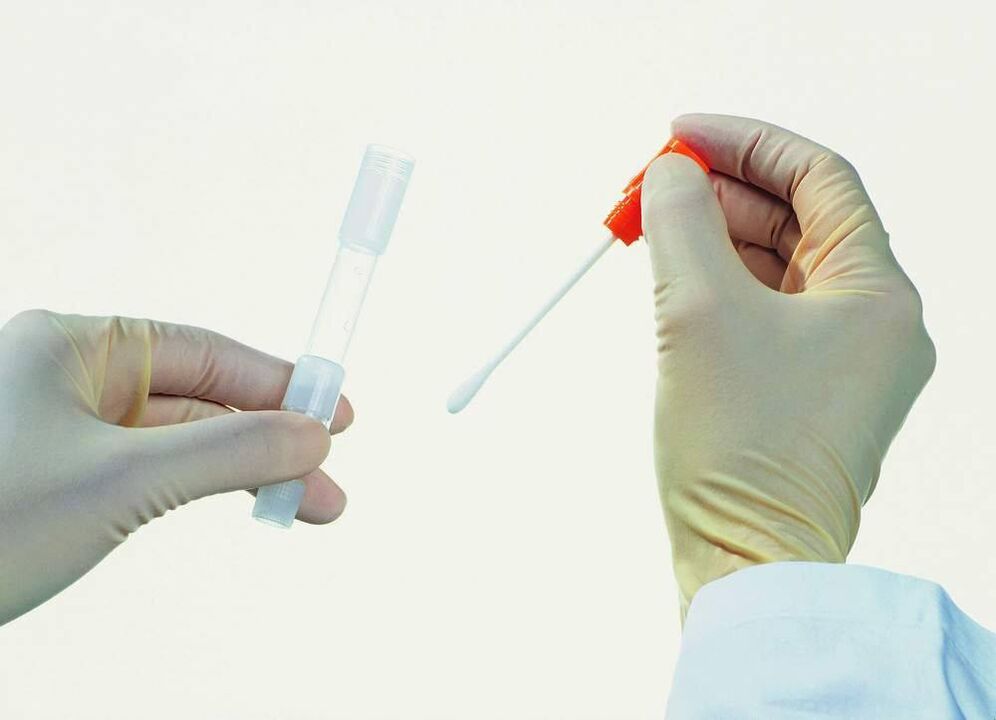 Collection d'analyse pour détecter la prostatite chronique